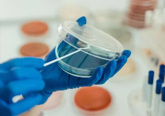 Plastic Quality Testing Services Reinvented – Advanced Validation by Kiyo R&D LAB