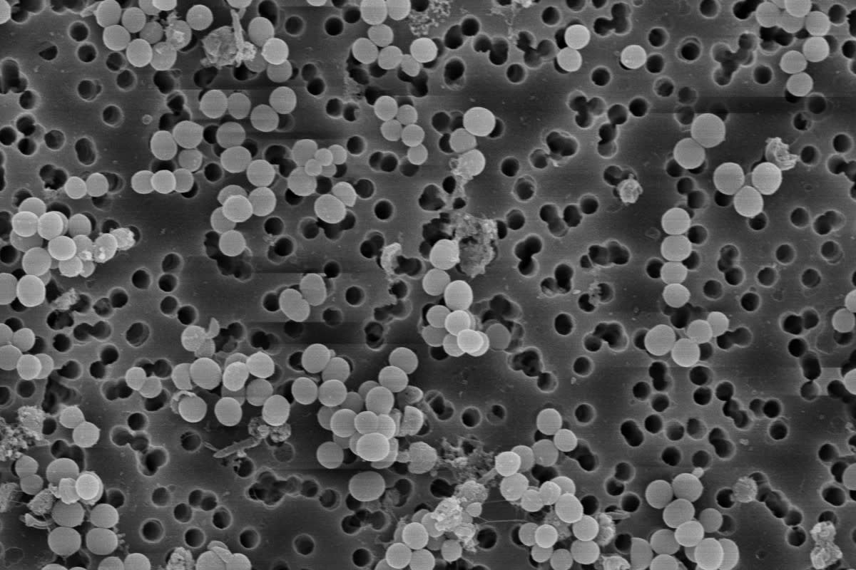 SEM with EDAX Analysis Services in Oragadam – Advanced Material Testing | Kiyo R&D LAB