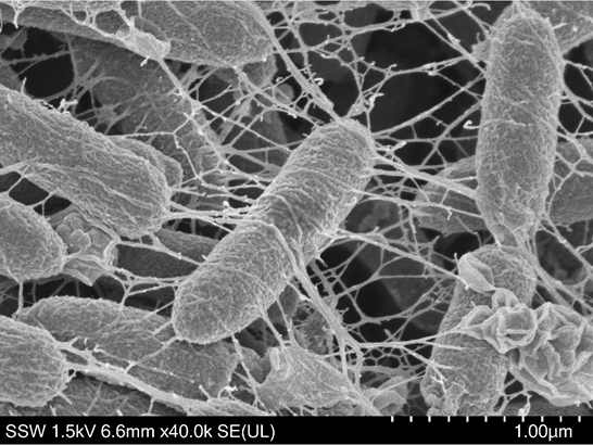 EDX Scanning Electron Microscope Analysis Lab in Chennai | Kiyo R&D Lab