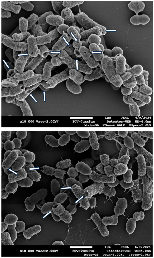 EDX Scanning Electron Microscope Analysis Lab in Chennai | Kiyo