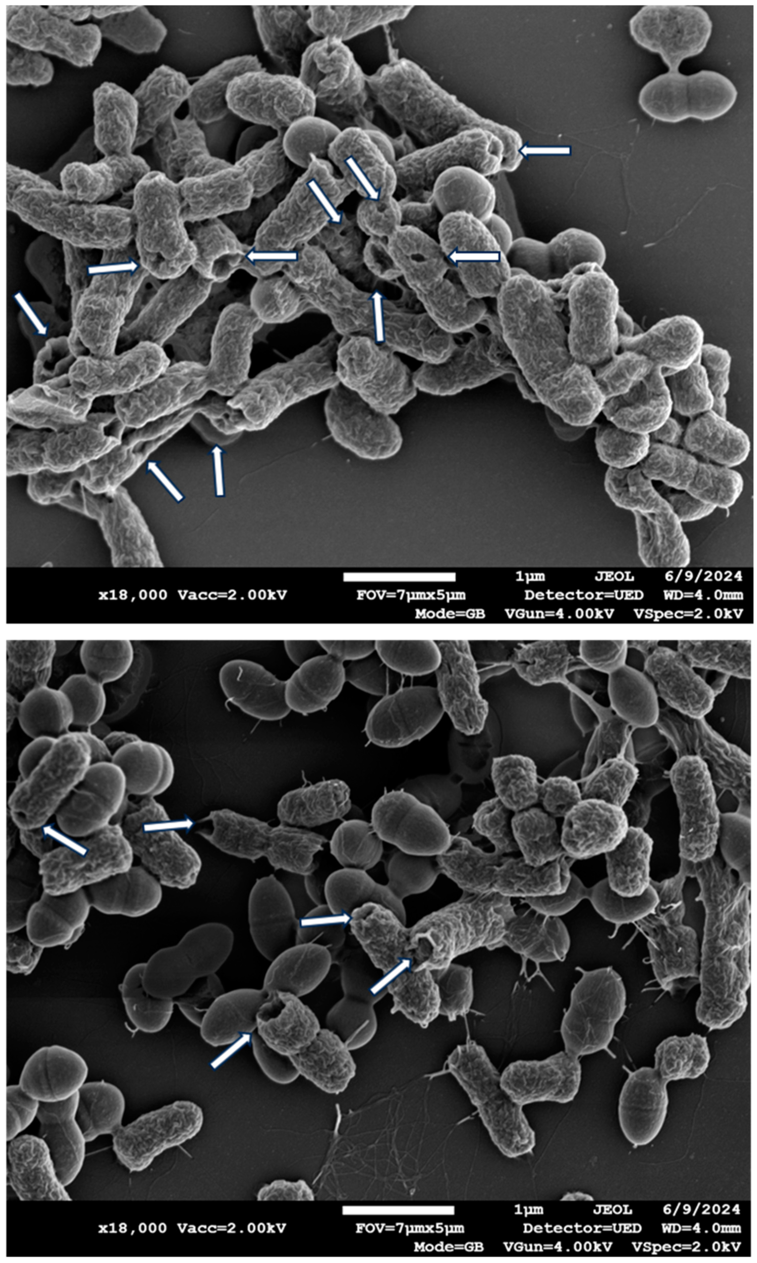 EDX Scanning Electron Microscope Analysis Lab in Chennai | Kiyo R&D Lab