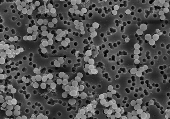 SEM-EDX Testing Lab | EDS Composition Testing Laboratory